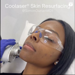 concept of patient getting coolaser skin resurfacing