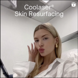 concept of woman about to have coolaser skin resurfacing
