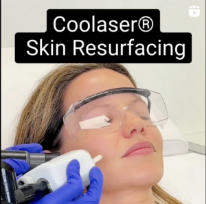 real patient having Coolaser skin resurfacing treatment at Epione